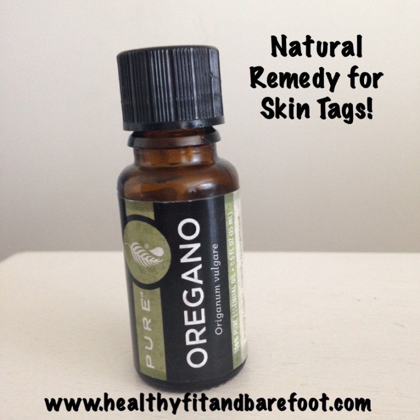 Oregano Essential Oil for Skin Tag Removal | Healthy, Fit & Barefoot!
